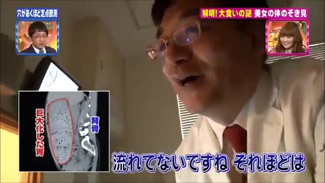 대식가의 메커니즘 규명.jpg_46.jpg