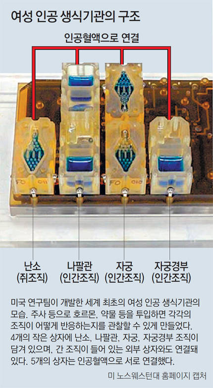 세계 최초 인공 생식기.jpg