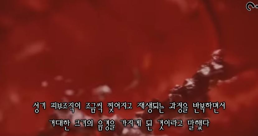 민간요법으로 세계최강 성기를 가지게 된 남자.jpg_5.jpg