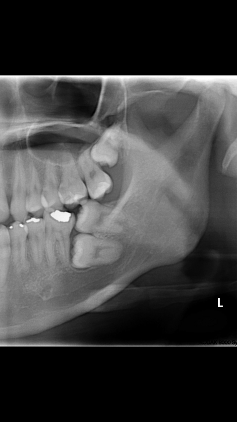 태어나서 부모를 처음으로 원망 해봤다는 일본 아가씨._1.jpg