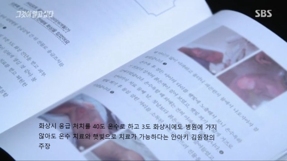 안아키식 화상 치료법_2.png