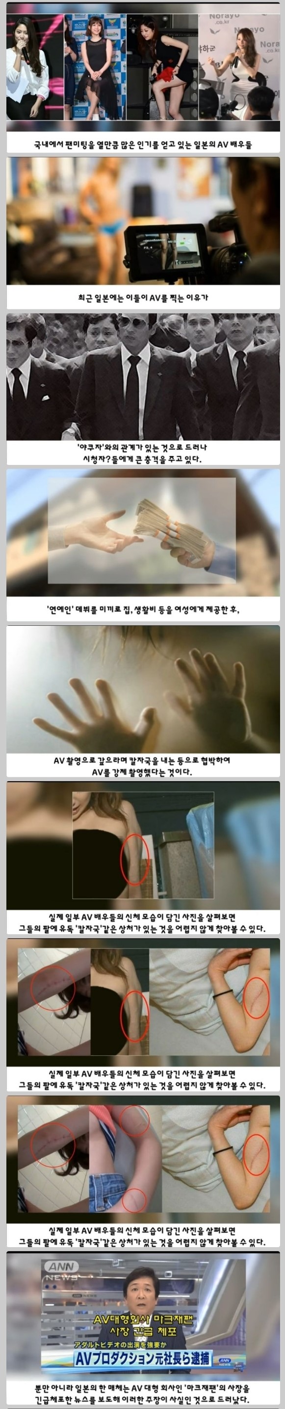 AV배우들의 몸에 유독 '칼빵'이 많은 이유_2.jpg
