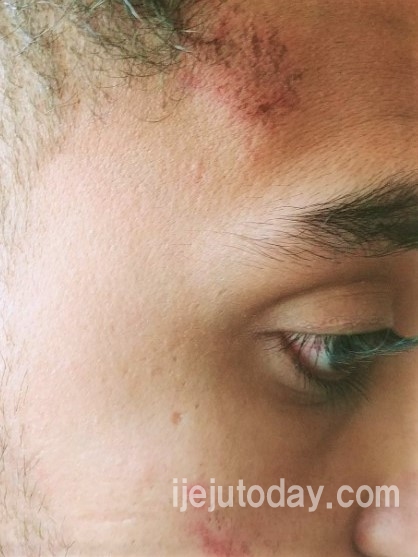 예멘인 2명, 한국인들에게 집단 폭행당해_2.jpg