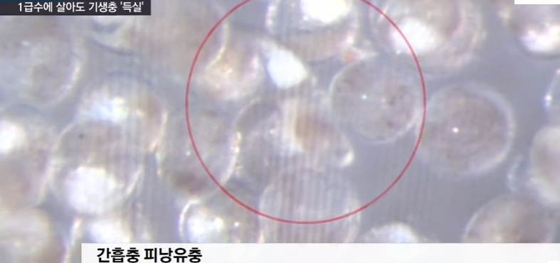 [혐주의] 1급수에 사는 민물고기라도 기생충 천지._4.jpg