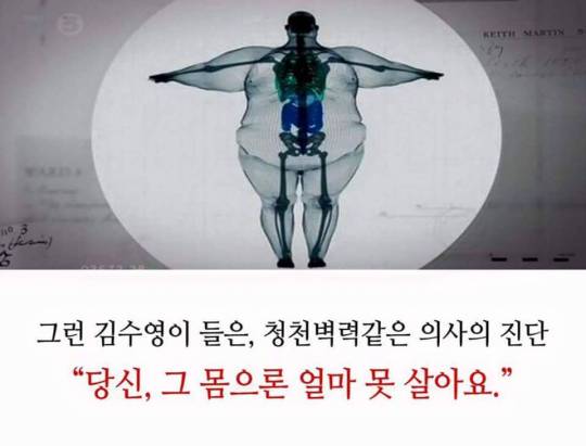 살기 위해 살을 뺀 개그맨 근황_3.jpg