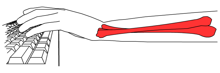 radius_ulna_twisted.png