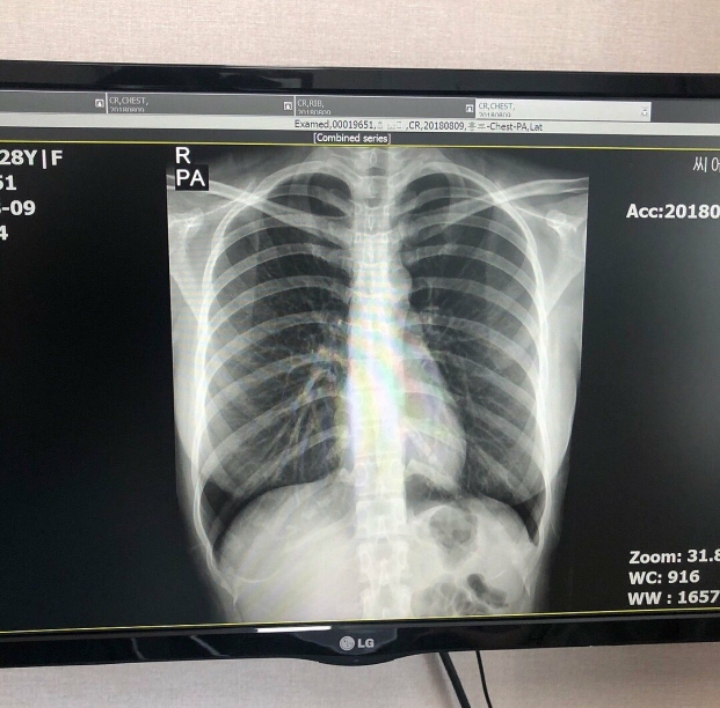 가슴 인증녀_6.jpg