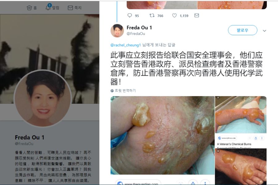 [혐주의]미친 중국 공산당 새끼들 - 홍콩 시위 진압에 생화학무기?_3.png