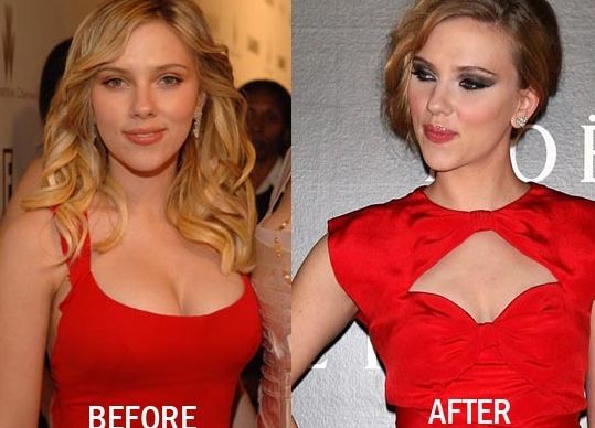 스칼렛 요한슨 축소수술 전 .... fact_1.jpg