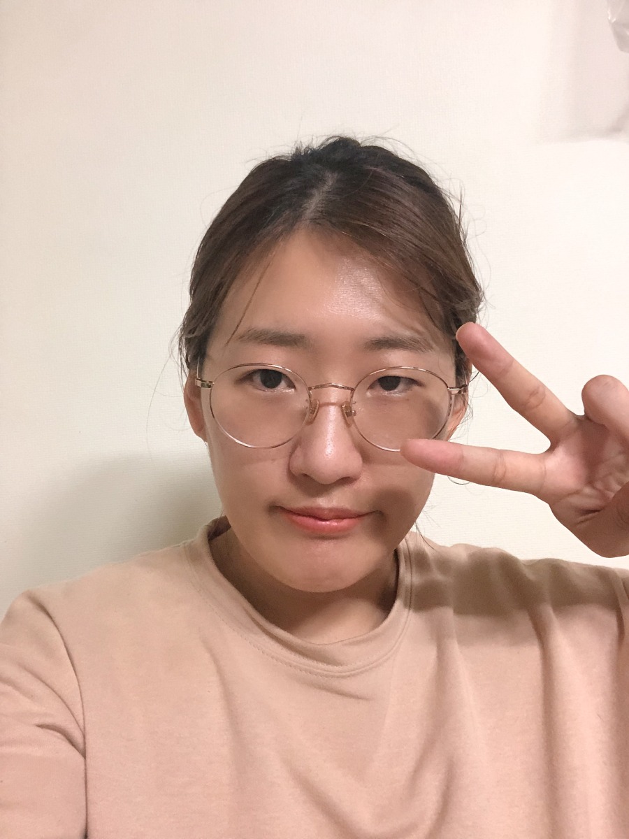 양악수술 후 곧 8개월차 전후비교