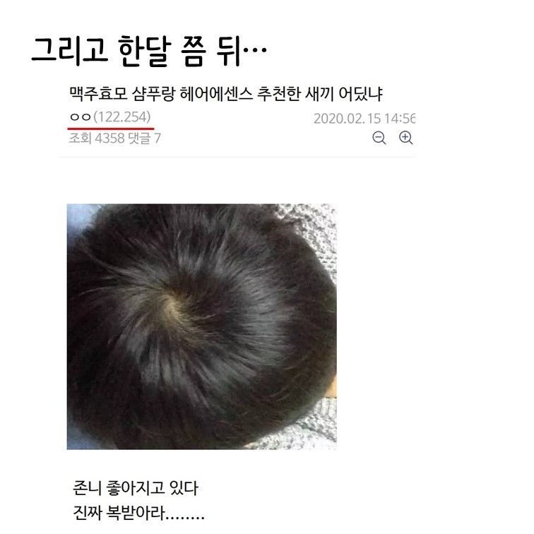 탈모갤 맥주효모빌런_4.jpg