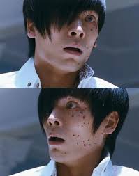 치질수술) 선생님... 방귀 나올 것 같아요...!!_1.jpg