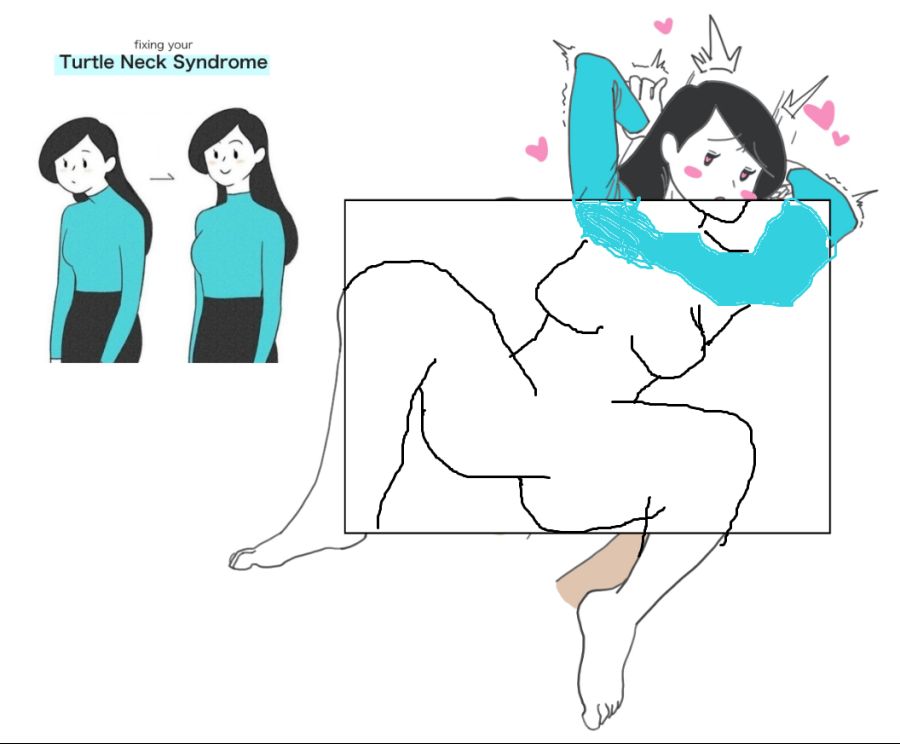 베글 거북목 글 원본 찾아봤다!_2.png