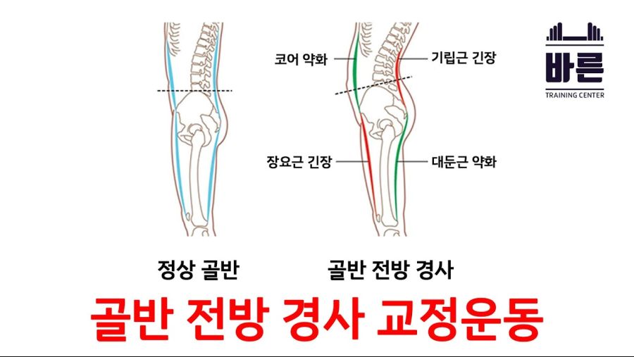 원신 감우의 골반전방경사에 대해서 알아보자 araboza