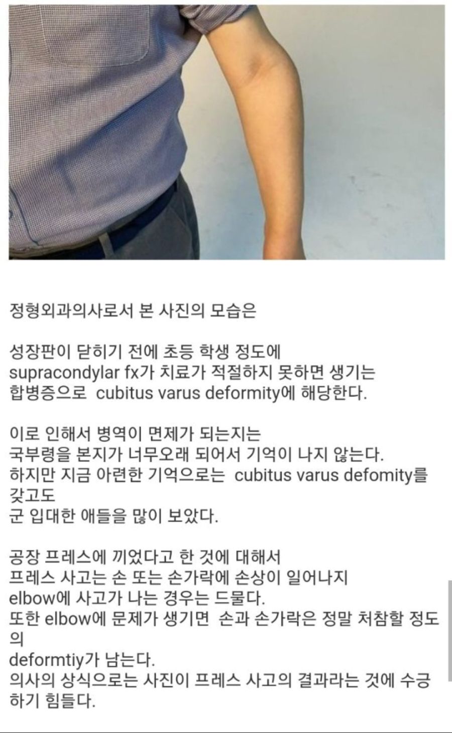 정형외과 의사가 본 잼명이 팔