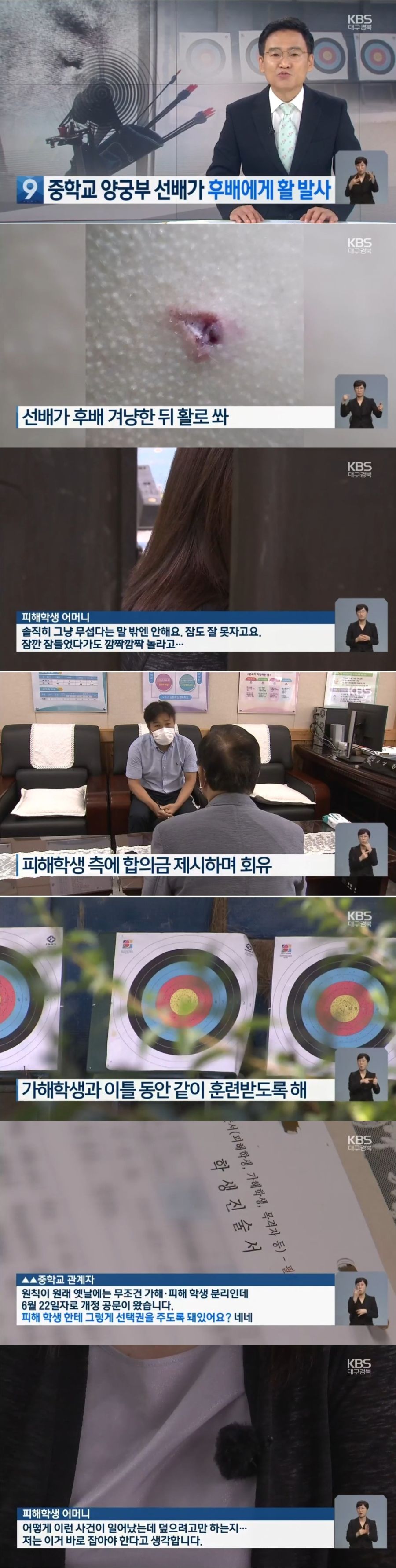 중학교 양궁부 선배가 후배 활로 쏴_1.jpg