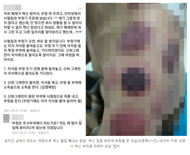 코로나 백신 부항 빼내기2.png