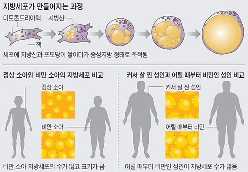 지방2.jpg