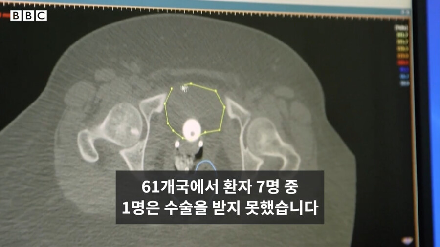 BBC) 코로나 백신과 신 암치료 방법_35.png