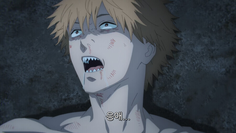 체인소) 환자가 숨을 쉬지않습니다_1.jpeg