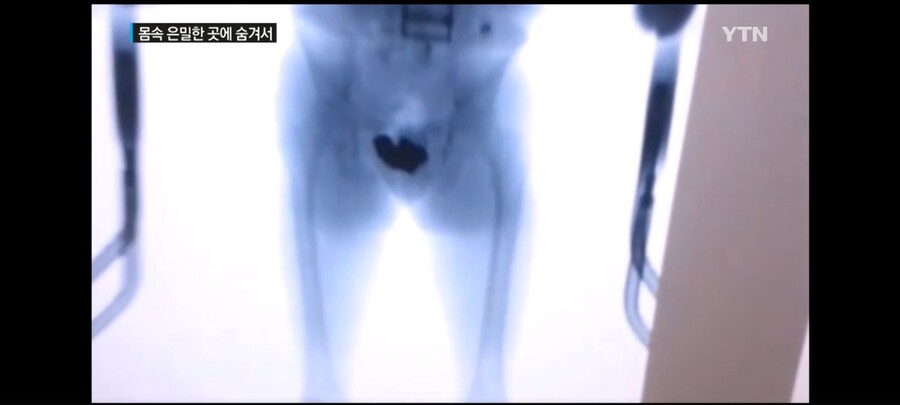 전설의 1천억원짜리 황금 똥꼬.jpg_2.jpg