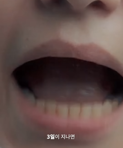 한달동안 이를 닦지 않으면 생기는 일_13.png
