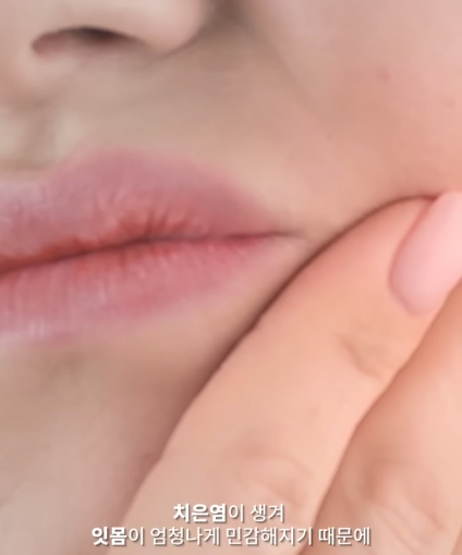 한달동안 이를 닦지 않으면 생기는 일_19.jpg