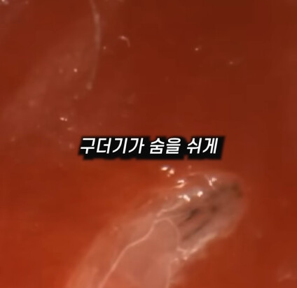 [혐] 딸기에 있는 하얀 털의 비밀_26.png