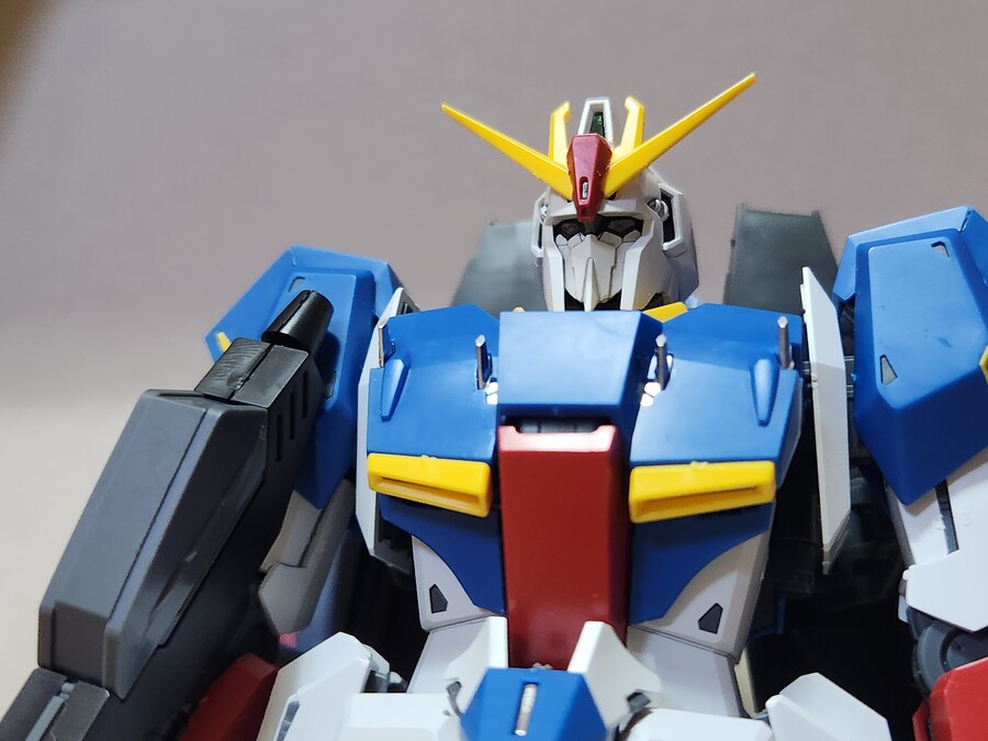 [MG] 제타 버카 양악수술 버전_3.jpg