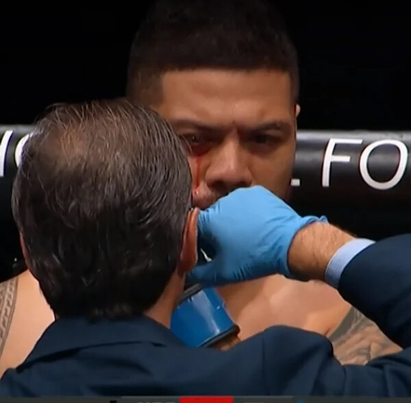 약혐?) 오늘자 UFC 살벌한 써밍 반칙 ㄷㄷ..GIF_1.jpg