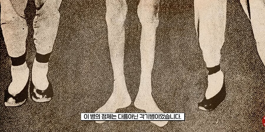 유독 일본 에도시대에 발생했다는 풍토병.jpg_12.jpg