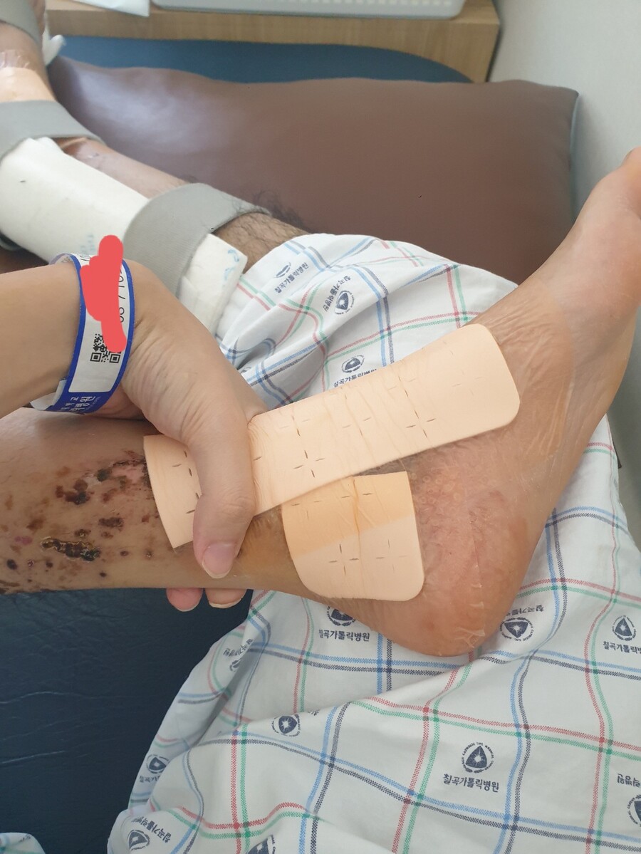 혐 스압 )내 다리 상태가 유머_7.jpg