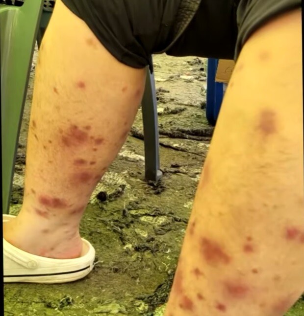 잼버리 대원들 발 사진jpg
