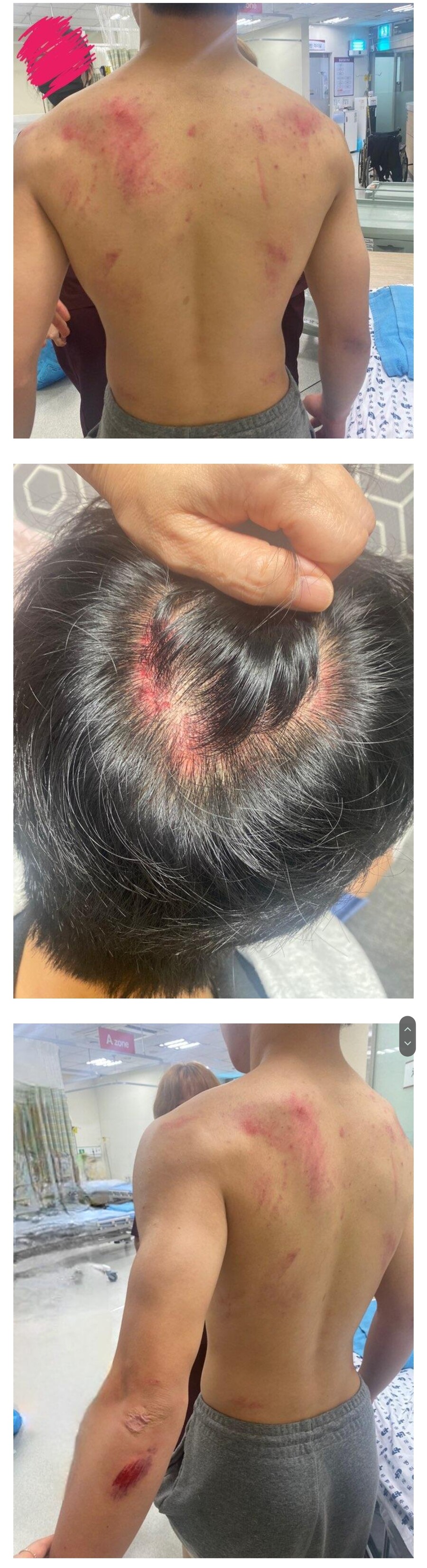 상처)금오동 칼부림 관련 오보 피해_1.jpg