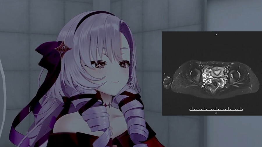 버튜버) 위 내시경 살로메는 잊어라!_2.png