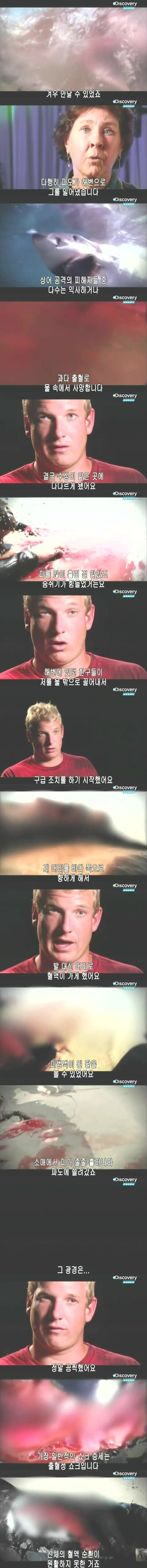 [극혐] 상어한테 물린 사람.jpg_6.jpg