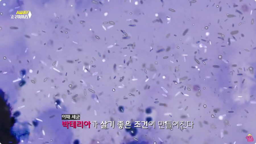 [스압] 한달 동안 머리를 감지 않으면 생기는 일.jpg_4.jpg