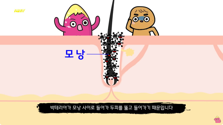 [스압] 한달 동안 머리를 감지 않으면 생기는 일.jpg_32.png