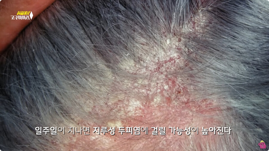[스압] 한달 동안 머리를 감지 않으면 생기는 일.jpg_35.jpg