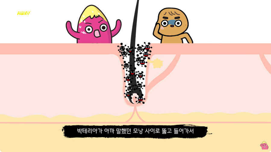 [스압] 한달 동안 머리를 감지 않으면 생기는 일.jpg_38.png