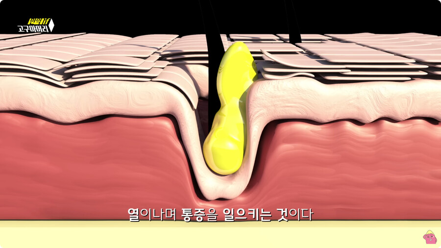 [스압] 한달 동안 머리를 감지 않으면 생기는 일.jpg_49.jpg