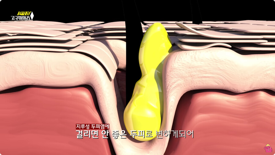 [스압] 한달 동안 머리를 감지 않으면 생기는 일.jpg_55.jpg
