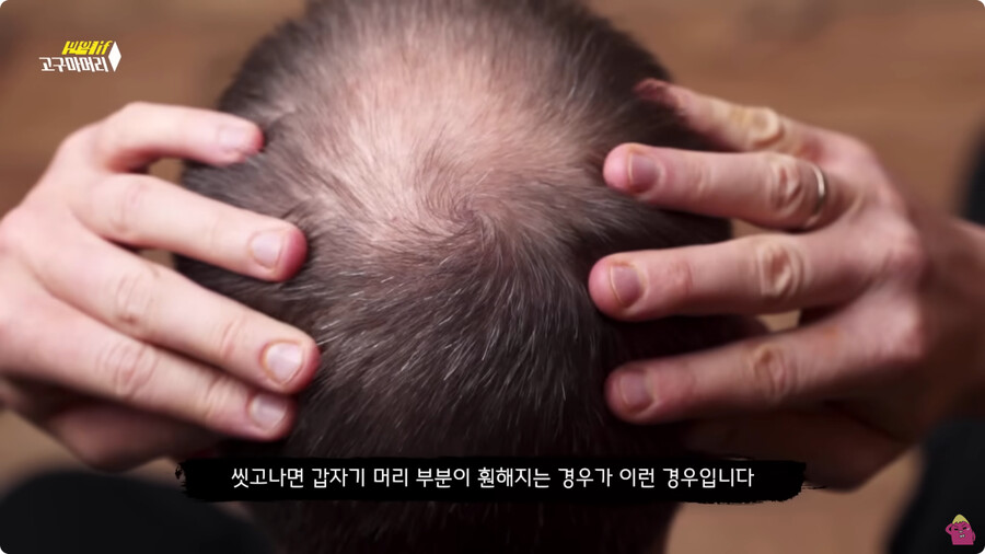 [스압] 한달 동안 머리를 감지 않으면 생기는 일.jpg_75.jpg