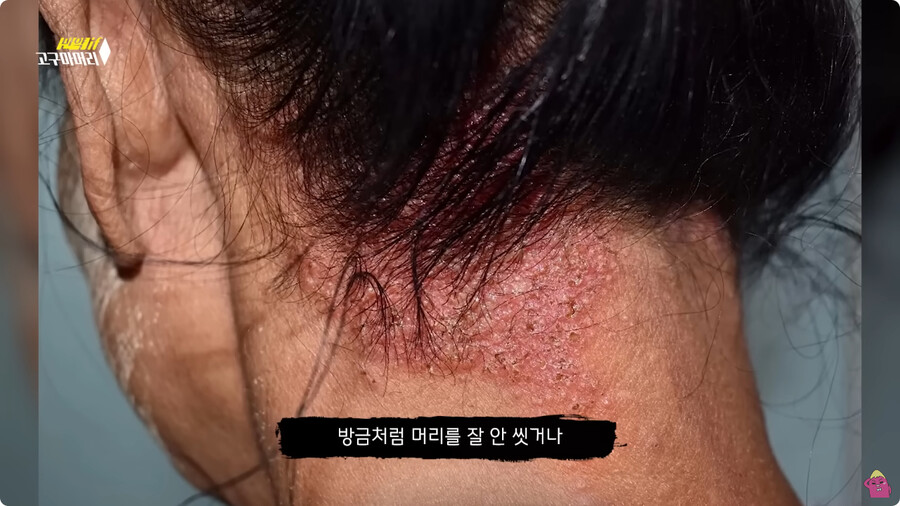 [스압] 한달 동안 머리를 감지 않으면 생기는 일.jpg_78.jpg