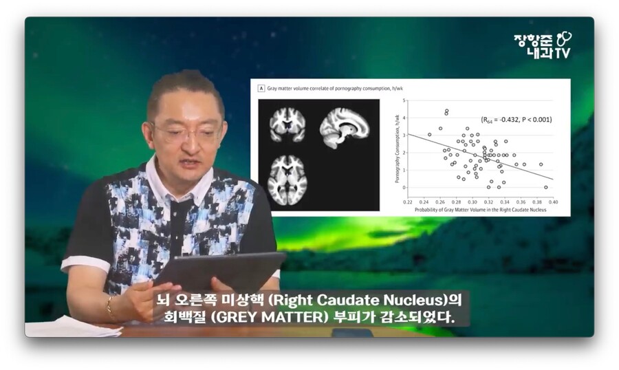 야동 시청시간에 비례해서 뇌가 쪼그라든다는 연구 결과.jpg_1.jpeg