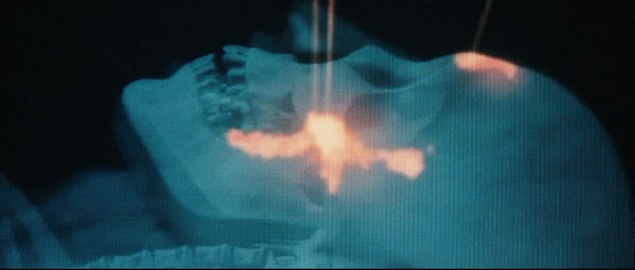 [엑스맨]아다만티움을 이식받는 울버린_6.jpg