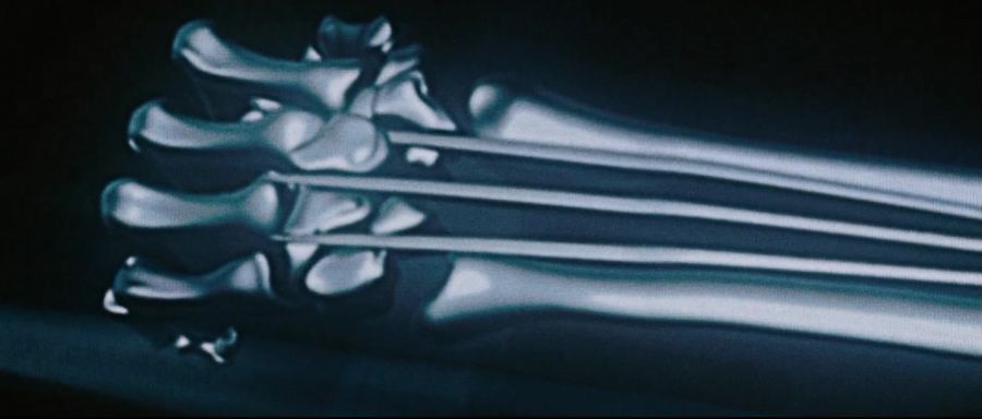 [엑스맨]아다만티움을 이식받는 울버린_13.jpg