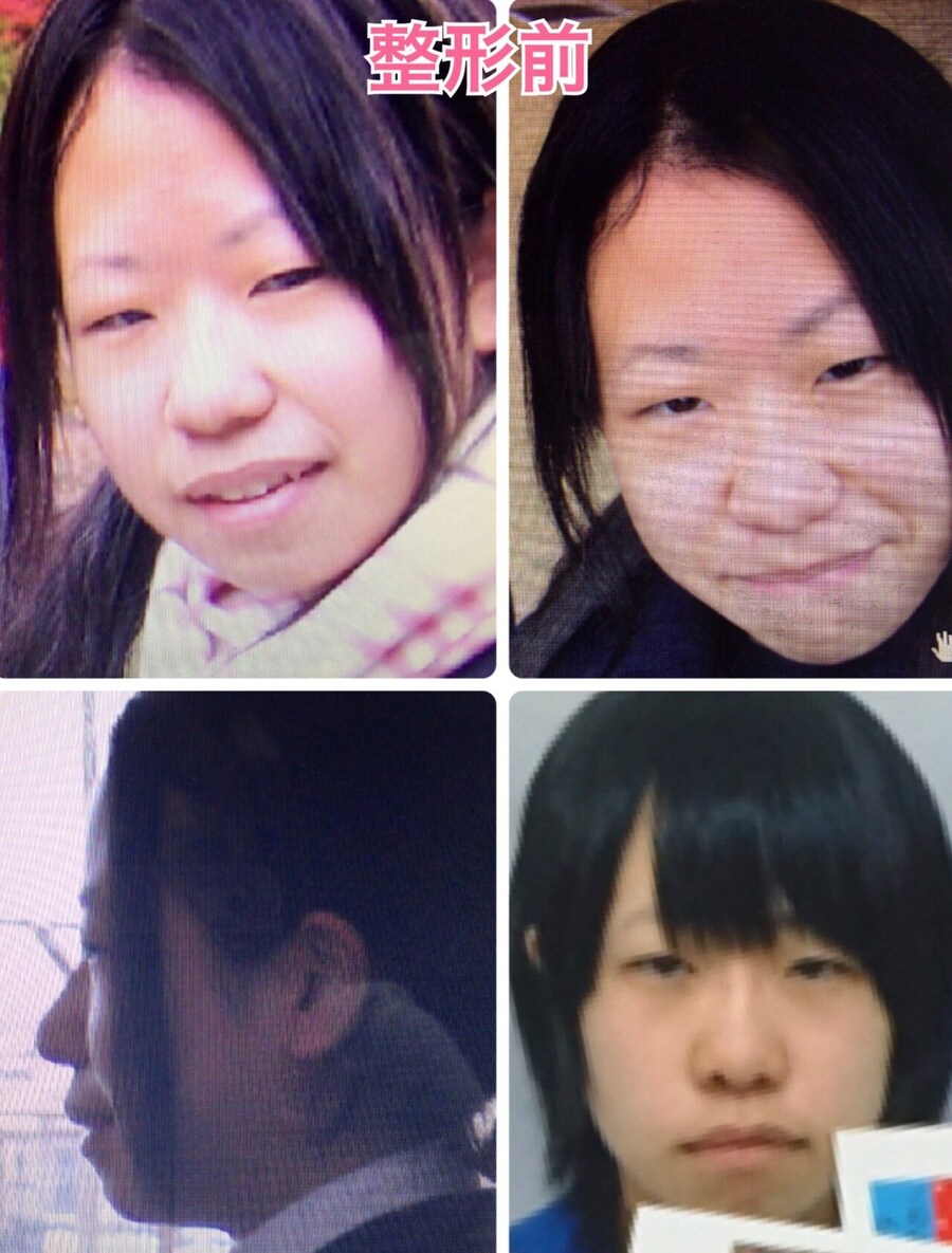 외모로 놀림당해 극단적 선택 까지 했던 일본여성_1.jpg