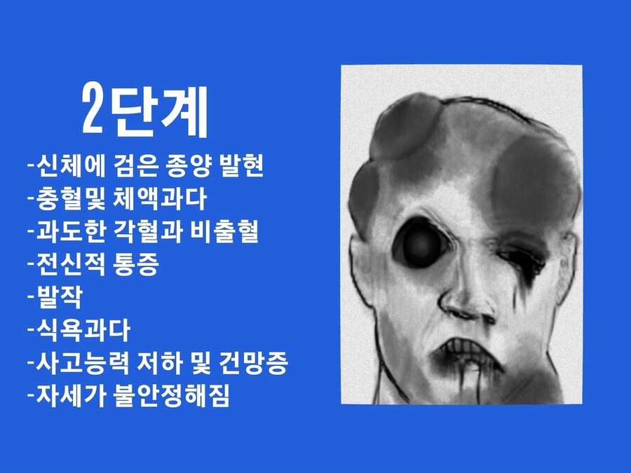 공포)종양거미분열증 안내사항_6.jpg