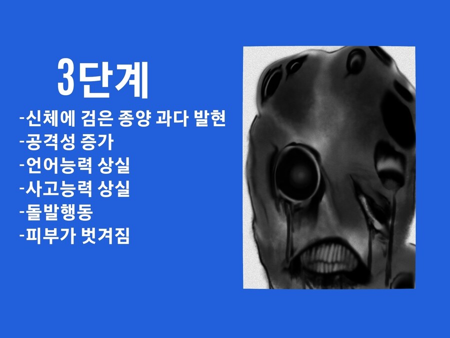 공포)종양거미분열증 안내사항_7.jpg